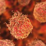 Lipid enzyme blocker renders prostate cancer cells vulnerable to PARP inhibitors in study